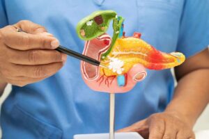 Pancreas